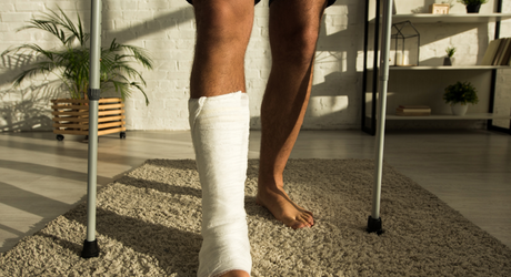 Did you know you can Insure your voice or legs? The craziest policies ever