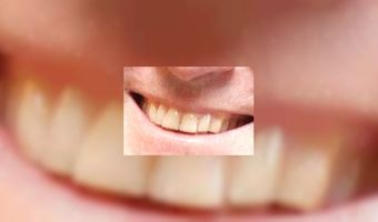 Optimisme onder hoteliers neemt toe