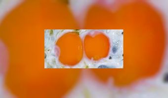 Hartig ontbijt goed voor trek naar suiker