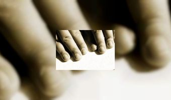 Hilton The Hague biedt info in braille